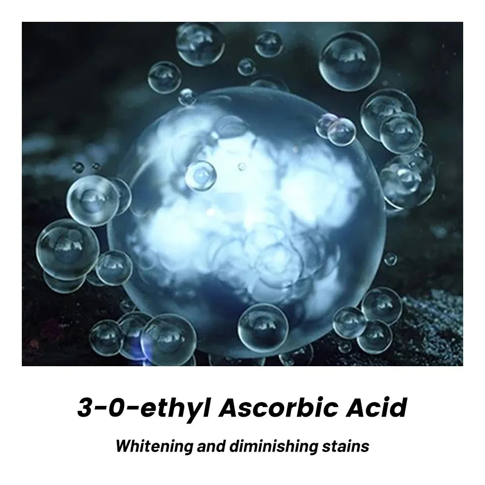 Image of 20G Whitening Freckle Cream Remove Dark Spot Cream Anti Freckle And 1072775698 from Edmene LLC