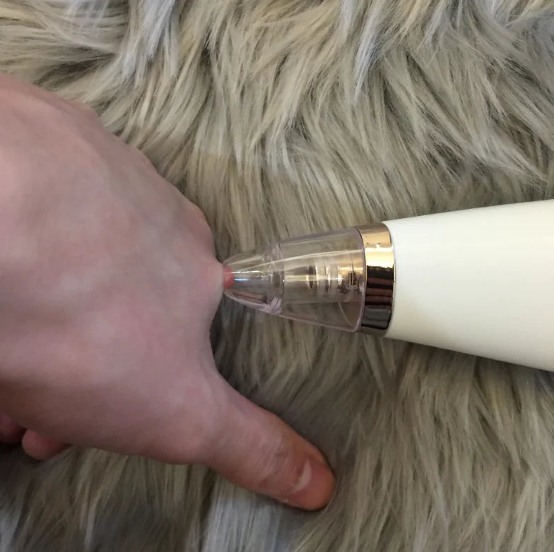 Blackhead Removal Device for Pore Cleansing and Skincare