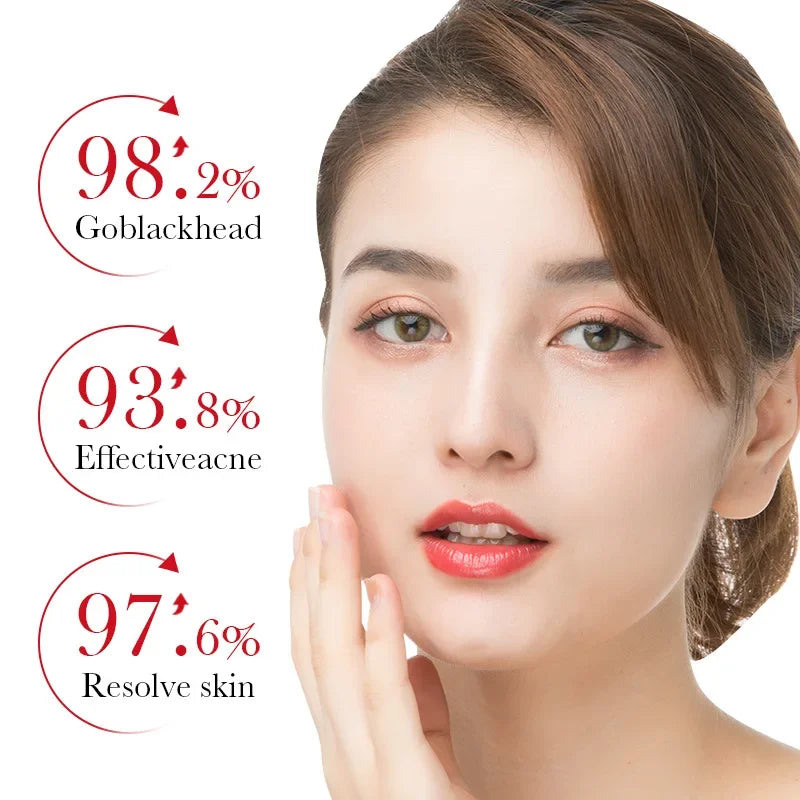 Image of Bioaqua Salicylic Acid Acne Removing Essence Face Serum Skincare 533803994 from Edmene LLC