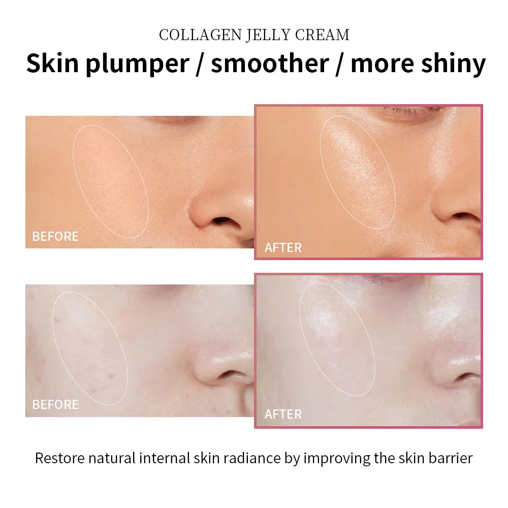 Image of 100Ml Collagen Jelly Cream Niacinamide Tightening Soothing 1112270154 from Edmene LLC