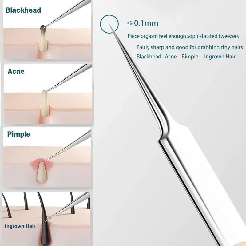 Image of 11Pcs Ingrown Hair Tweezers Acne Blackhead Removal Needles Black Dots 662138327 from Edmene LLC