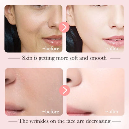 Image of Bioaqua Niacinamide Serum For Reducing Dark Spots Whitening And 854309388 from Edmene LLC