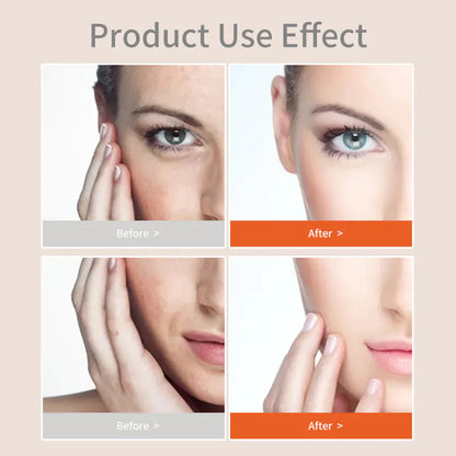 Turmeric Skincare Set: Toner, Cream, Serum, Mask, Scrub